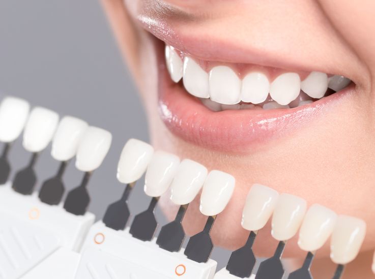 Tooth Whitening